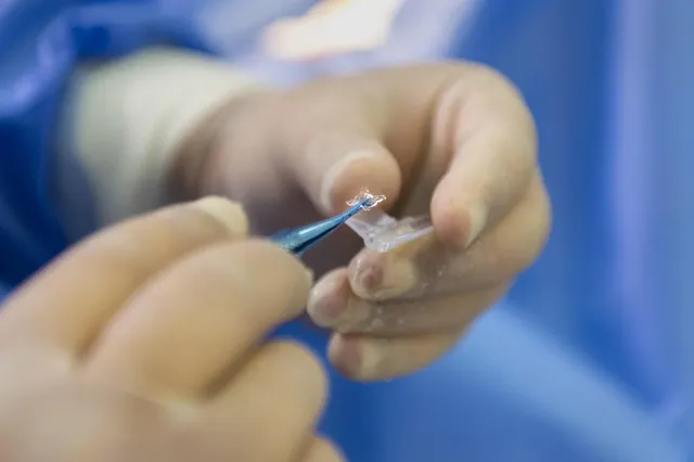 Laparoscopic Colorectal Surgery and TaTME